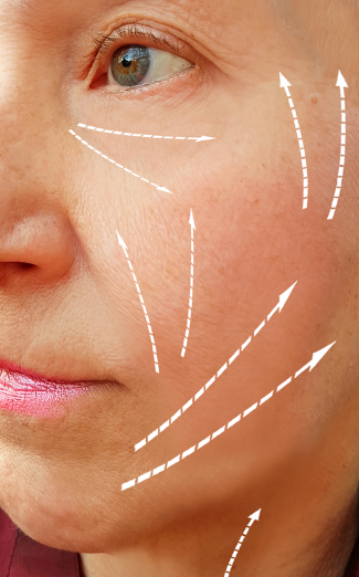 Paciente después del tratamiento de firmeza facial